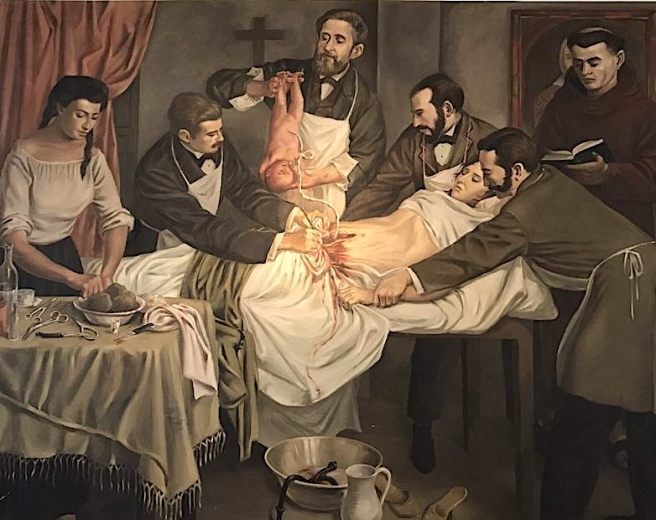 Caesarean section.jpg